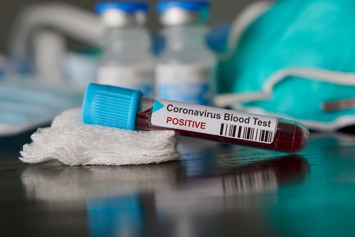 Coronavirus, comune per comune i dati dei contagi in provincia di Varese all'8 aprile
