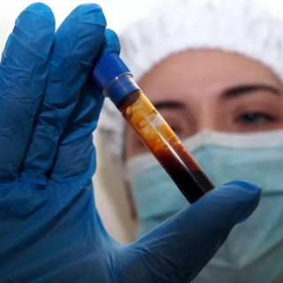 Hantavirus, negativo il turista inglese in quarantena a Milano