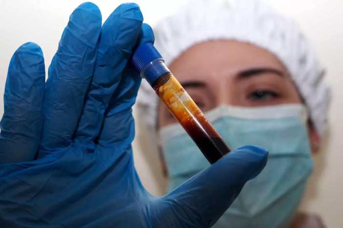 Hantavirus, negativo il turista inglese in quarantena a Milano