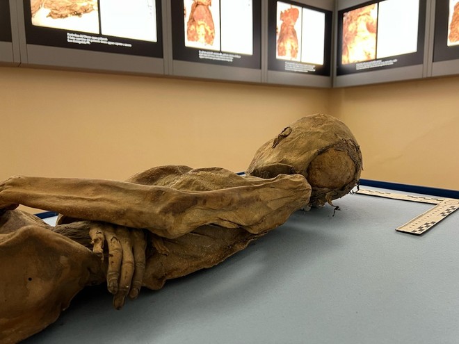 La mummia del bambino di Villa Mirabello