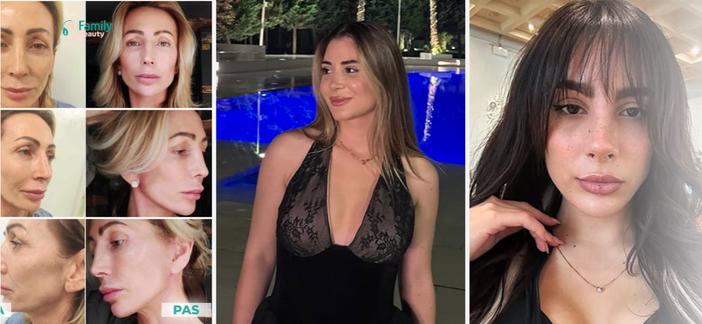 Chirurgia Plastica Albania: perché sempre più italiani scelgono Tirana per gli interventi estetici