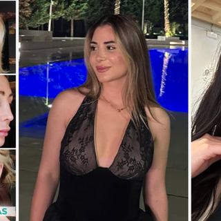 Chirurgia Plastica Albania: perché sempre più italiani scelgono Tirana per gli interventi estetici