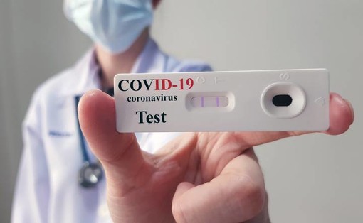 Test sierologici, da Regione Lombardia il via libera per sottoporsi all'esame che scova gli anticorpi del Coronavirus