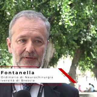 Neurochirurgia, Fontanella: "Bisogna lottare insieme, con i pazienti e con tutta la tecnologia" Neurochirurgia, Fontanella: "Bisogna lottare insieme, con i pazienti e con tutta la tecnologia"