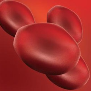 Autoemotrasfusione di ozono anti-aging, cos'è: ma fa bene davvero? Autoemotrasfusione di ozono anti-aging, cos'è: ma fa bene davvero?