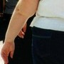 Una morte per malattie infettive su 10 è legata all'obesità, lo studio