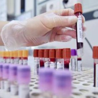 Dal microbiota una speranza contro l'epilessia resistente, lo studio italiano Dal microbiota una speranza contro l'epilessia resistente, lo studio italiano