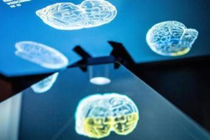 Ictus, ecco come l'emisfero sano del cervello influenza la ripresa: la ricerca rivoluzionaria