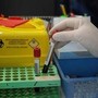 Tumori, nuovo test del sangue 'low cost' promette di scoprire diversi tipi di cancro Tumori, nuovo test del sangue 'low cost' promette di scoprire diversi tipi di cancro