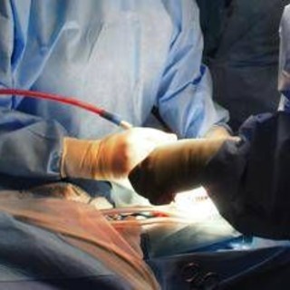 Trapianto di fegato completamente robotico, a Padova la prima mondiale con tecnica innovativa