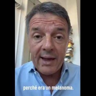Renzi e il melanoma: "L'ho rimosso, nessun rischio per me ma bisogna controllarsi"