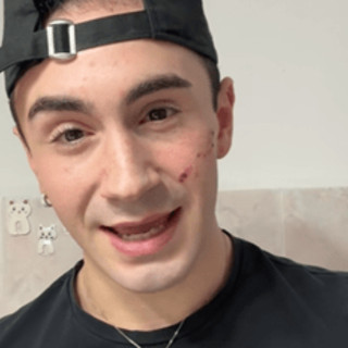 Genova, 19enne denuncia aggressione omofoba: "Sfregiato al viso con coltellino"