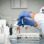 Alzheimer, nuovo test del sangue potrebbe prevedere sintomi imminenti Alzheimer, nuovo test del sangue potrebbe prevedere sintomi imminenti