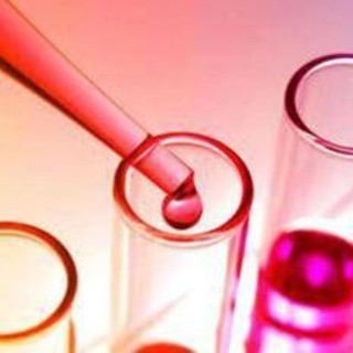 Patologie lisosomiali, assegnate le borse di ricerca 'Find For Rare'