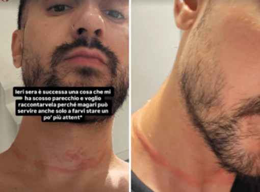 Mr. Daniel, il make-up artist dei vip, aggredito e rapinato a Milano: il racconto choc sui social