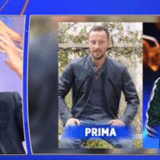 Francesco Facchinetti, la battaglia contro la calvizie: "Ho trovato la pace con una patch cutanea"