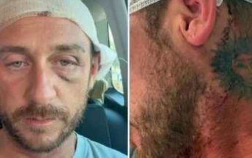 "Io aggredito a sassate in Sardegna da 30 persone perché gay", la denuncia sui social "Io aggredito a sassate in Sardegna da 30 persone perché gay", la denuncia sui social 