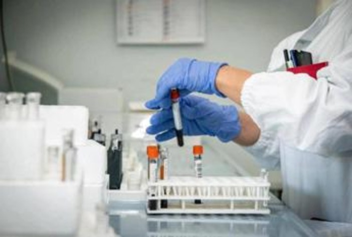 Alzheimer, nuovo test del sangue potrebbe prevedere sintomi imminenti Alzheimer, nuovo test del sangue potrebbe prevedere sintomi imminenti