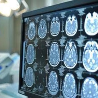 Giornata mondiale dell'Alzheimer, neurologi: "Ora percorsi cura più efficaci e sostenibili" Giornata mondiale dell'Alzheimer, neurologi: "Ora percorsi cura più efficaci e sostenibili"